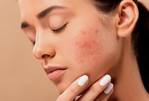 skin-disease treatment